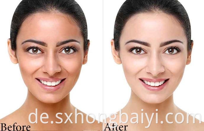 Before After Skin Whitening Zeta White 345x 2x